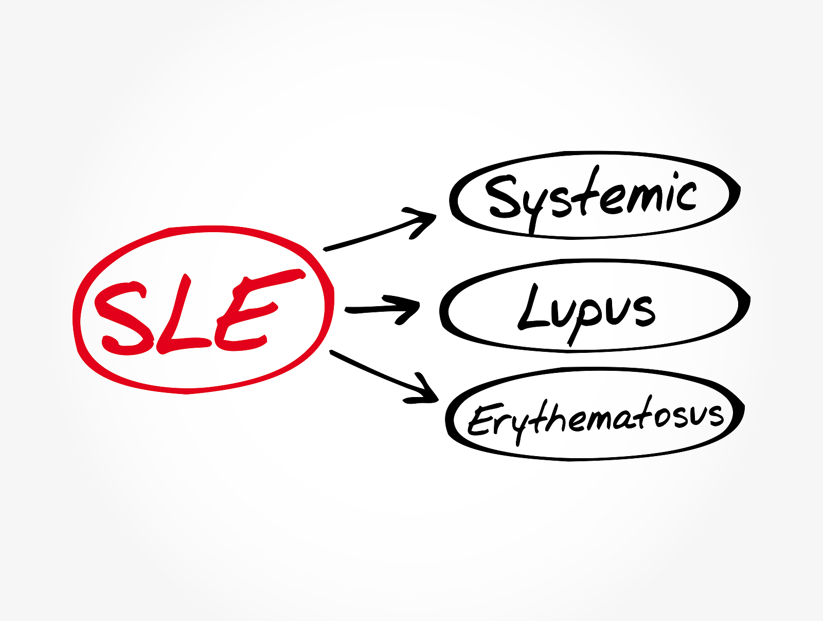 Complete remission best for tapering SLE treatment Institut SERVIER